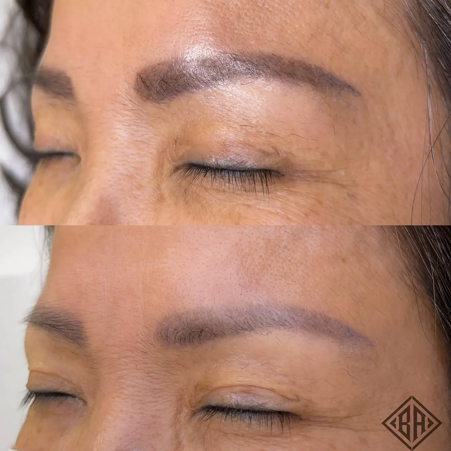 Before and After PMU Removal 1