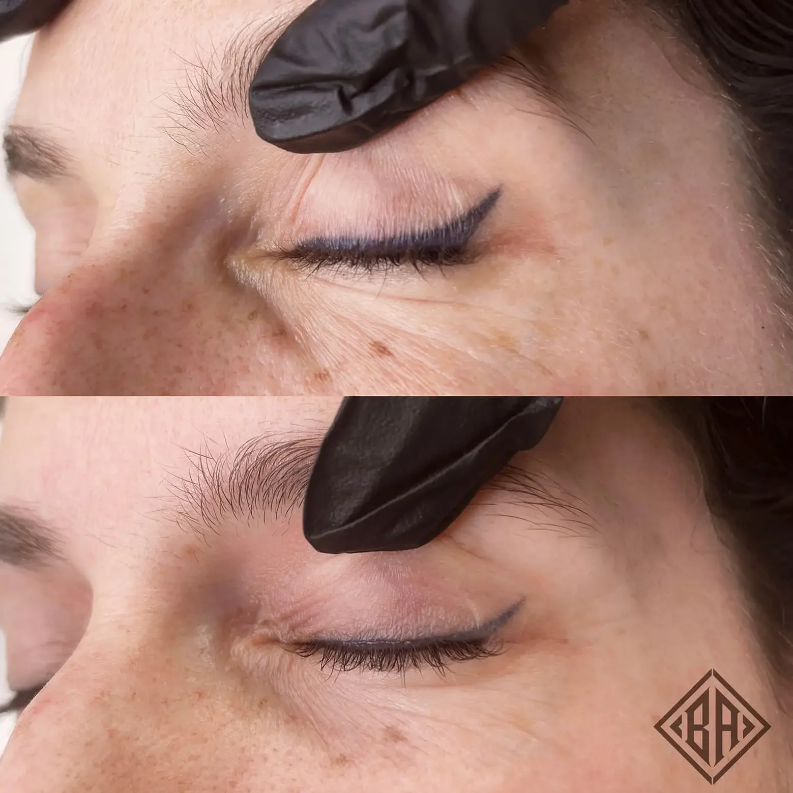 Beauty Angels Laser-Free Tattoo Removal — Beauty Art Pro, Geneva (3)